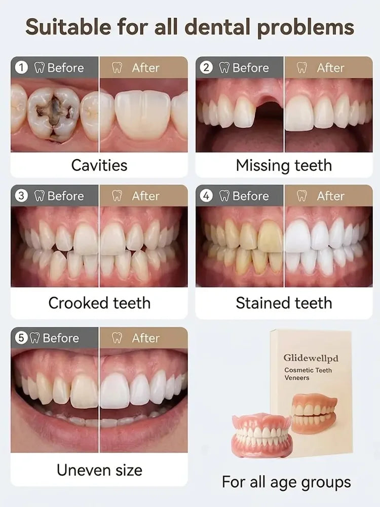 ⏳ Limited-Time Offer | Premium Full Cover Dentures