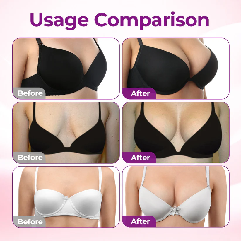 Alcuras@ Targeted Breast Enhancement Advanced Nano Microneedle Patch