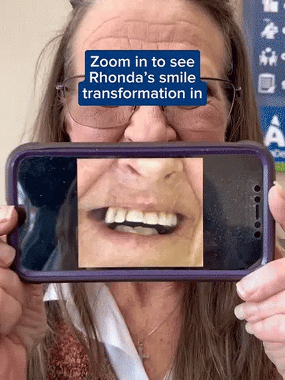 Instant Smile Dentures