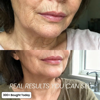 🎀Pink Collagen Volume Multi Balm🎀