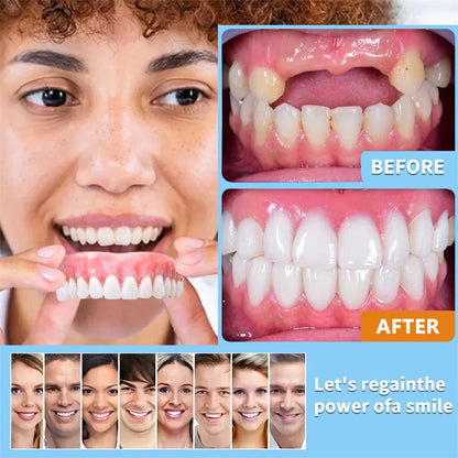 Custom-Fit Dentures -Designed for Comfort and a Natural-Looking Smile